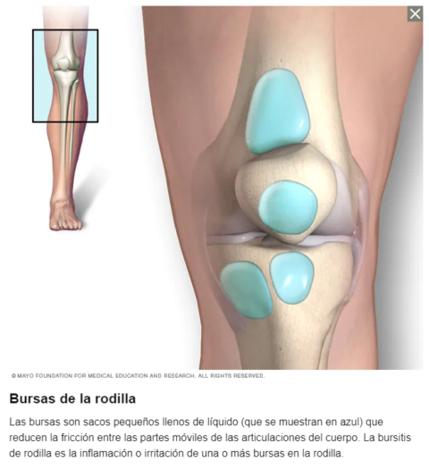 Bursitis De Rodilla Ortopedia Y Alta Especialidad Deportiva